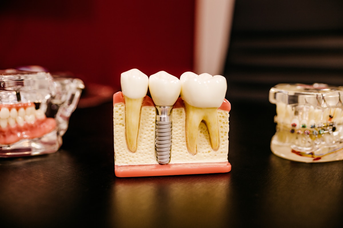 Dental implant surgery at Supreme Elite Clinic Kelambakkam OMR Chennai